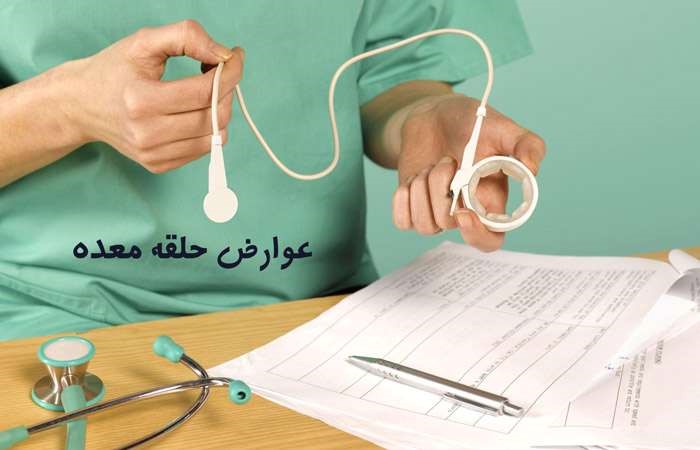 مهم ترین عوارض جراحی لاغری حلقه معده (باندینگ معده)