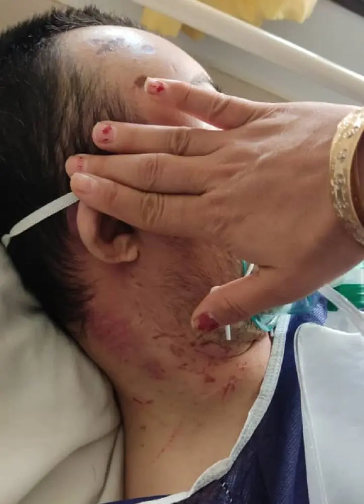 ضرب و شتم شدید معلول سمنانی + عکس و جزییات