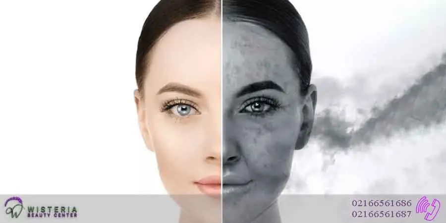 مراقبت-پوست