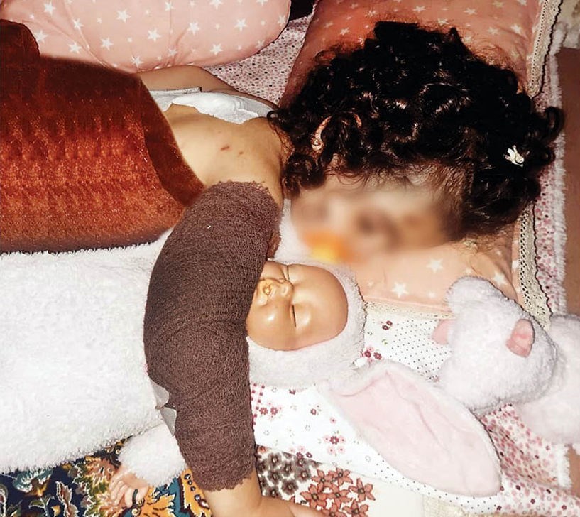 دختر-حمله-سگ